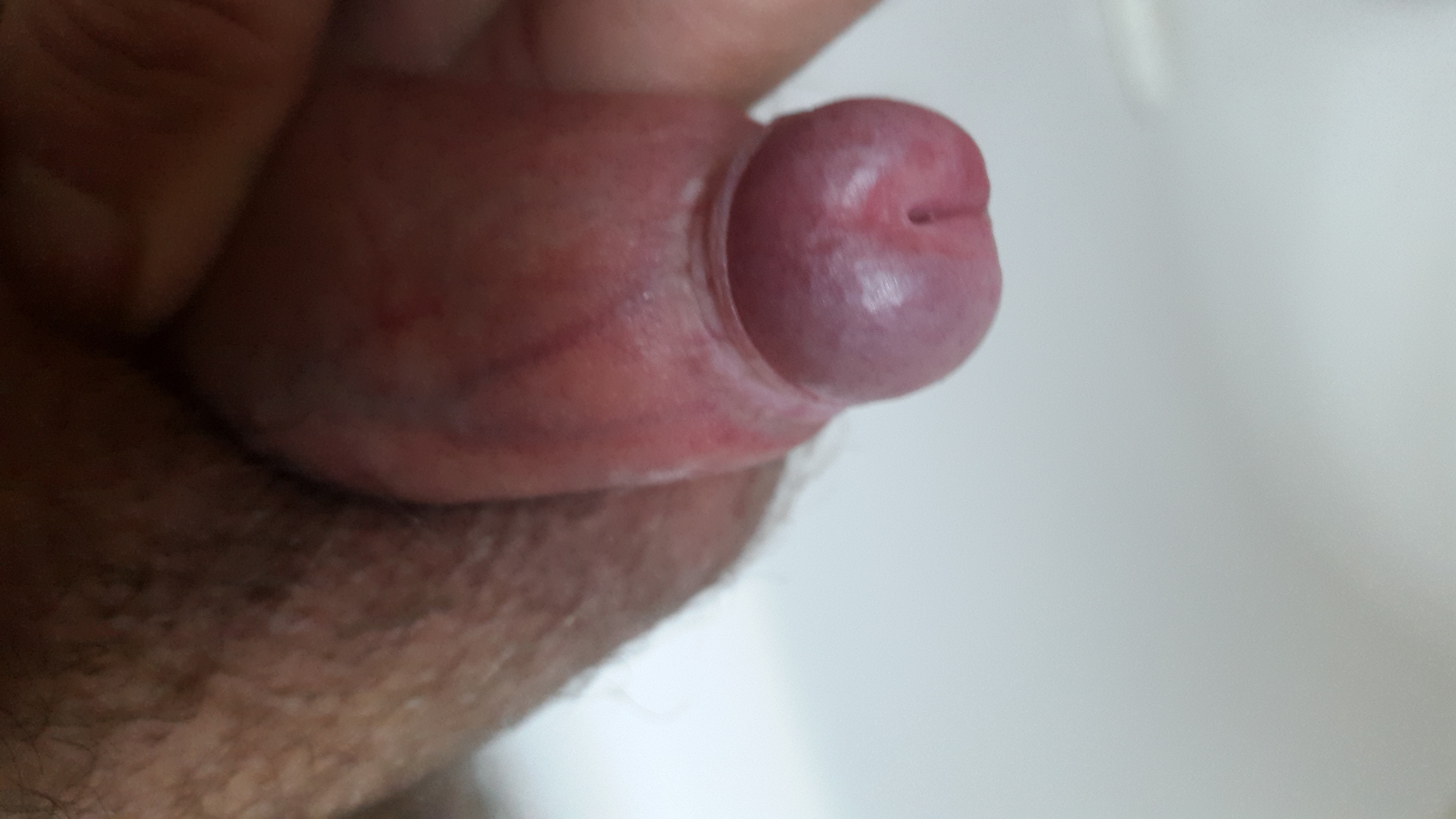 All About My Penis 70