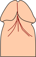 Diagram of frenulum of penis